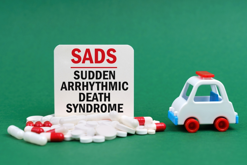 Medical concept. On a green surface, an ambulance, pills and a white sign with the inscription - Sudden arrhythmic death syndrome
