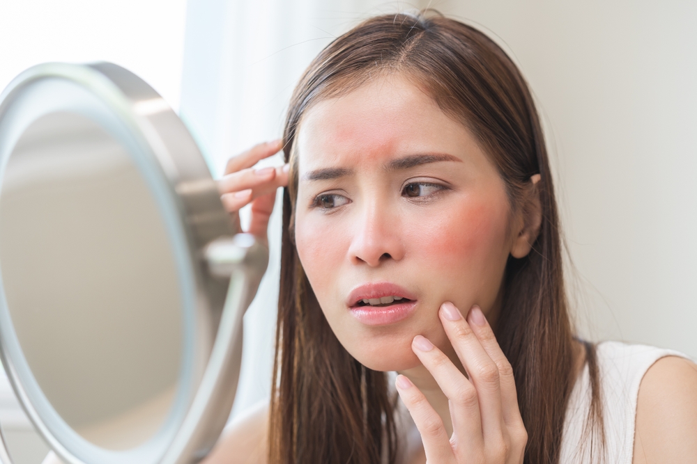 Dermatology, scratch asian young woman looking at mirror, expression worry and itch, itchy allergy or allergic sensitive reaction, red spot or rash on her face. Beauty care from skin problem treatment
