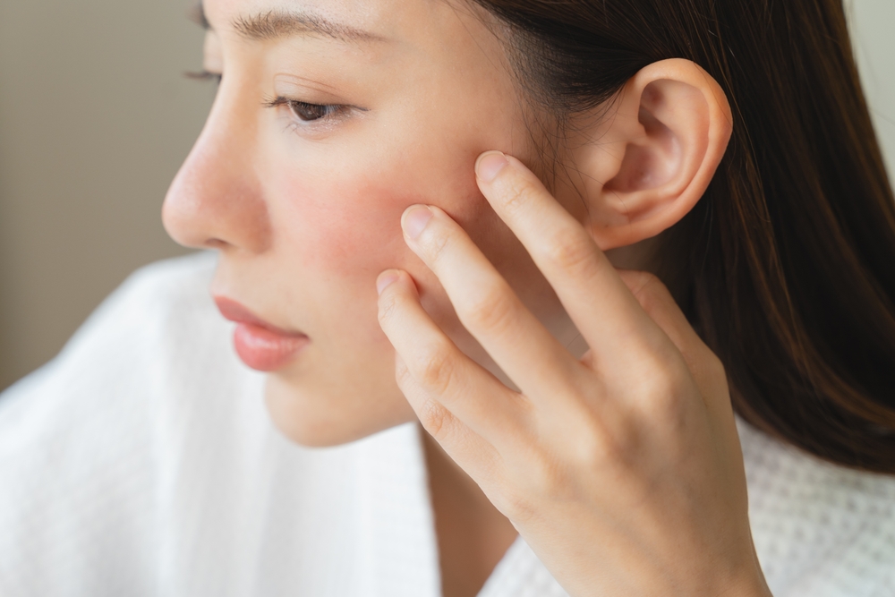Asian young woman looking face skin in the mirror have a red rash on her face from cosmetic allergy
