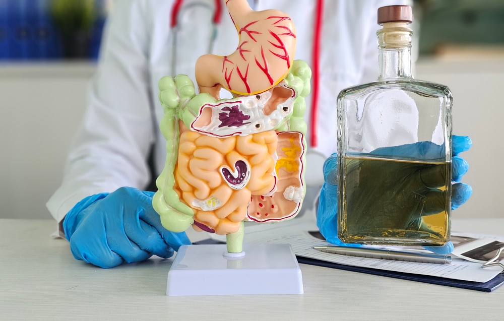 Doctor holds a model of the digestive system and a bottle of alcohol. Alcohol and intestinal diseases of the stomach
