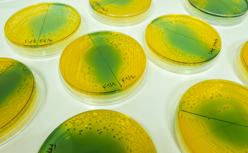 Vibrio on TCBS plate(selective medium for Vibrio growth) by cross streak technique 2 in 1 per plate
