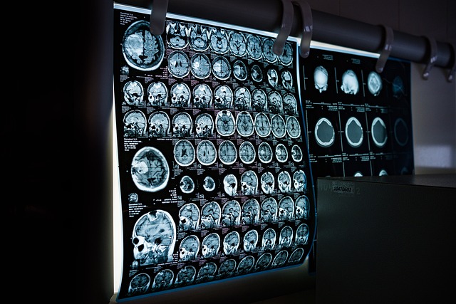 brain