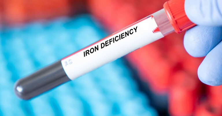 16 Signs You May Have Iron Deficiency - Featured image