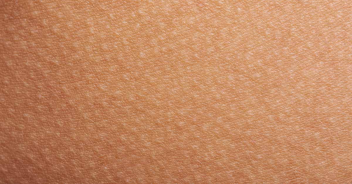 11 Reasons For Raised Bumps On Your Skin