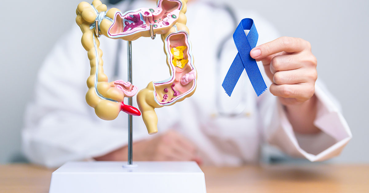 ‘I Thought I was Invincible’ 34-Year-Old Man Diagnosed with Colon Cancer ‘Kicks Himself’ For Ignoring Early Red Flag Symptoms