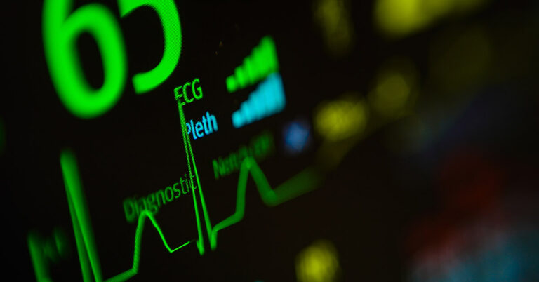 This 3D-Printed ‘Electronic Glove’ Might Keep Your Heart Beating for Life - Featured image