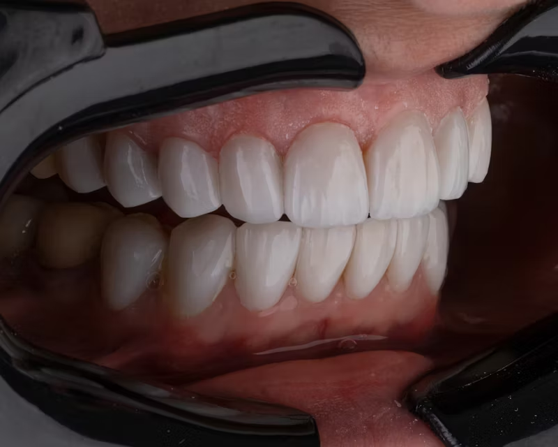 a close-up view of teeth