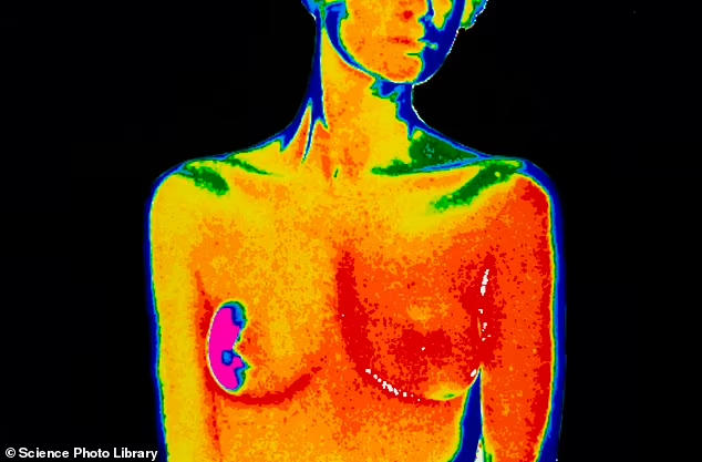 American doctors tracking women being treated for breast cancer have discovered the the injections — collectively known as glucagon-like peptide-1 receptor agonists, or GLP-1s — 'detrimentally affect' how the body responds to chemotherapy and immunotherapy