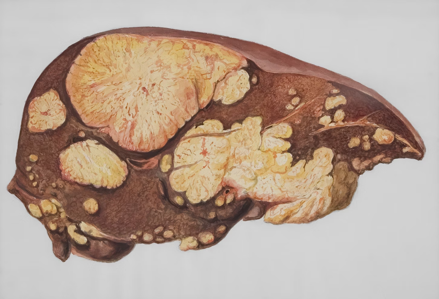 A human liver