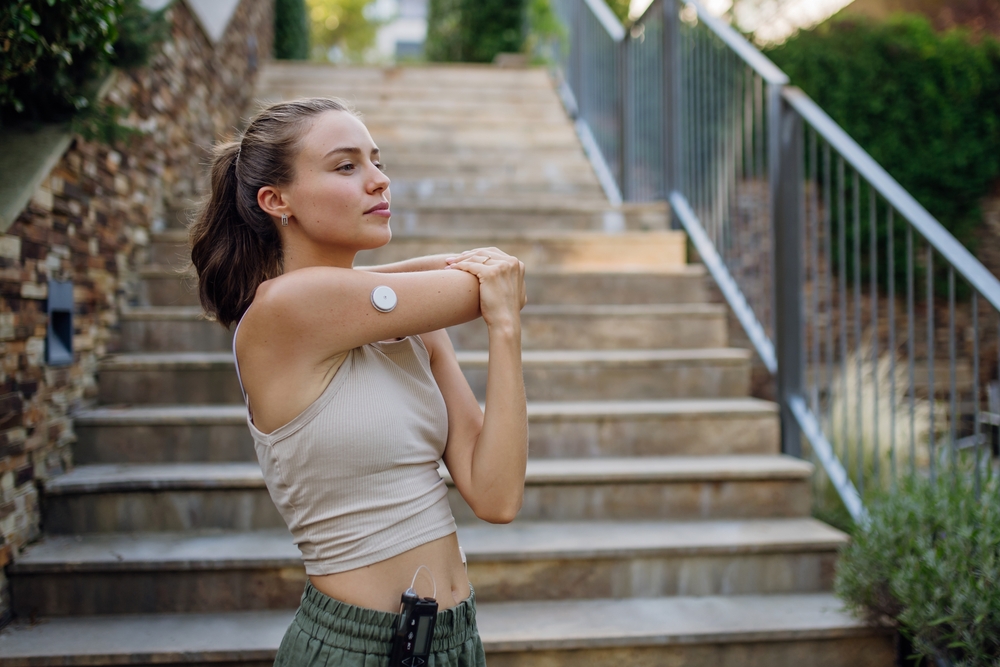 Beautiful diabetic woman preparing for outdoor run in the city.
