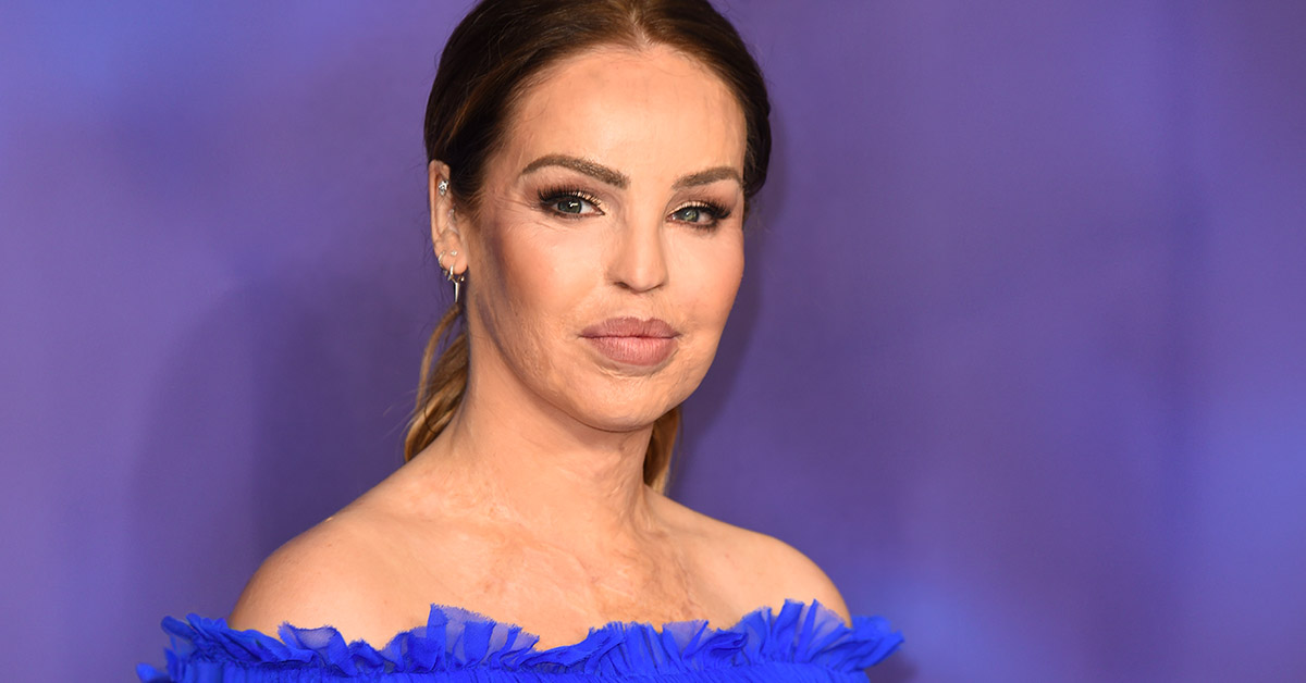 Katie Piper Gives Emotional ‘End of the Road’ Update After Years of Eye Health Battles
