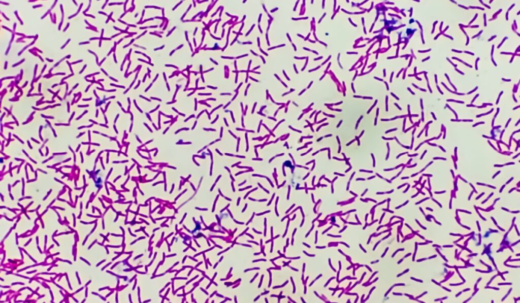Microscopic view of gram stain showing rod shape Escherichia coli or E. coli bacteria