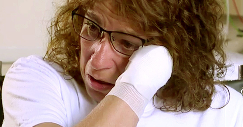 Dog Saliva Causes Ohio Woman to Lose Legs and Arms