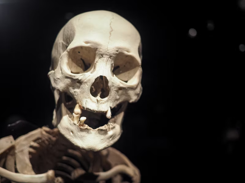 an older skull missing teeth