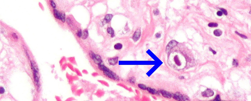 CMV-infected human placental cell.