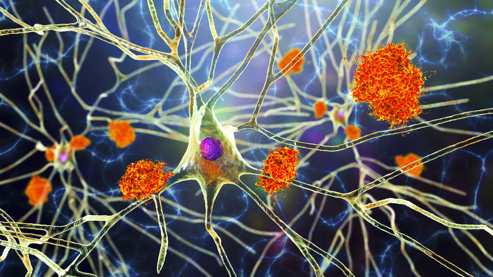 immune system cells with microglia around them