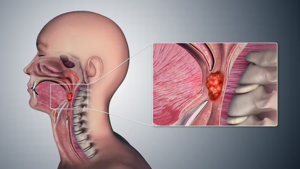 The oropharynx is middle section of the throat (pharynx).