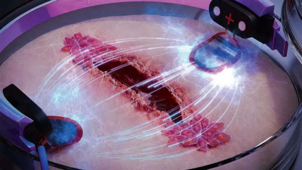 Skin wounds healing in the presence of an electric field.