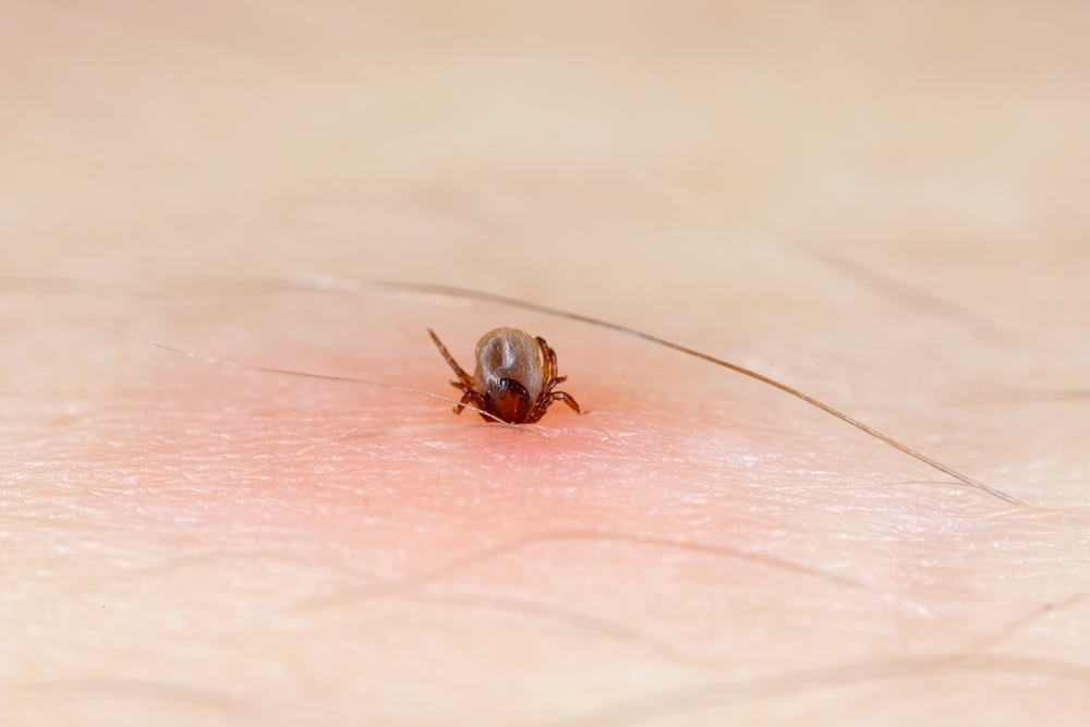 Sucking tick macro photo on human skin. Ixodes ricinus. Dangerous mite. carries pathogens that can cause disease: encephalitis, erythema that may show Lyme disease infection.
