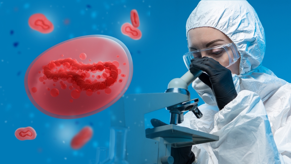 Doctor investigates Monkeypox. Search for Monkeypox in blood. Monkey disease cells on blue. Woman doctor microscope. Virologist in chemical protection suit. Monkeypox epidemic. New strain smallpox
