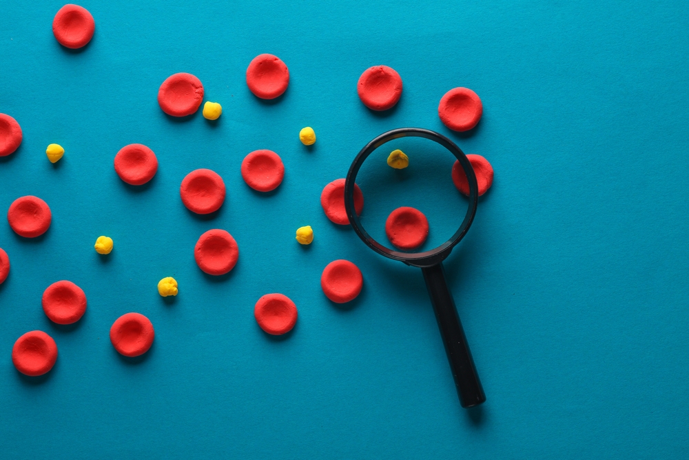 Red blood cells with lipids model and magnifying glass on blue background. Cholesterol
