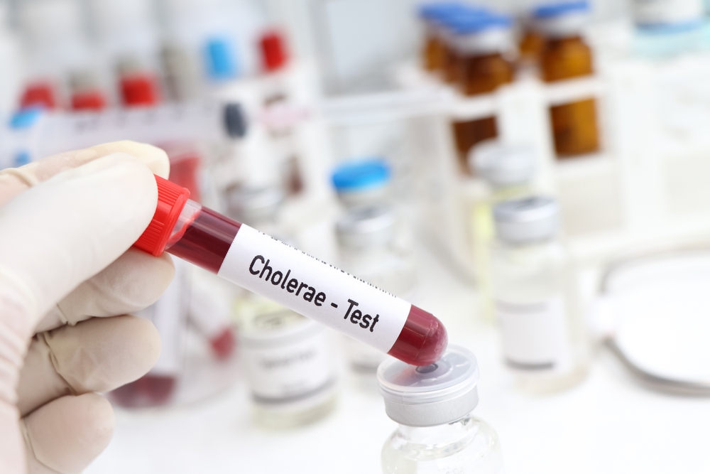 Cholerae test to look for abnormalities from blood, scientific experiment