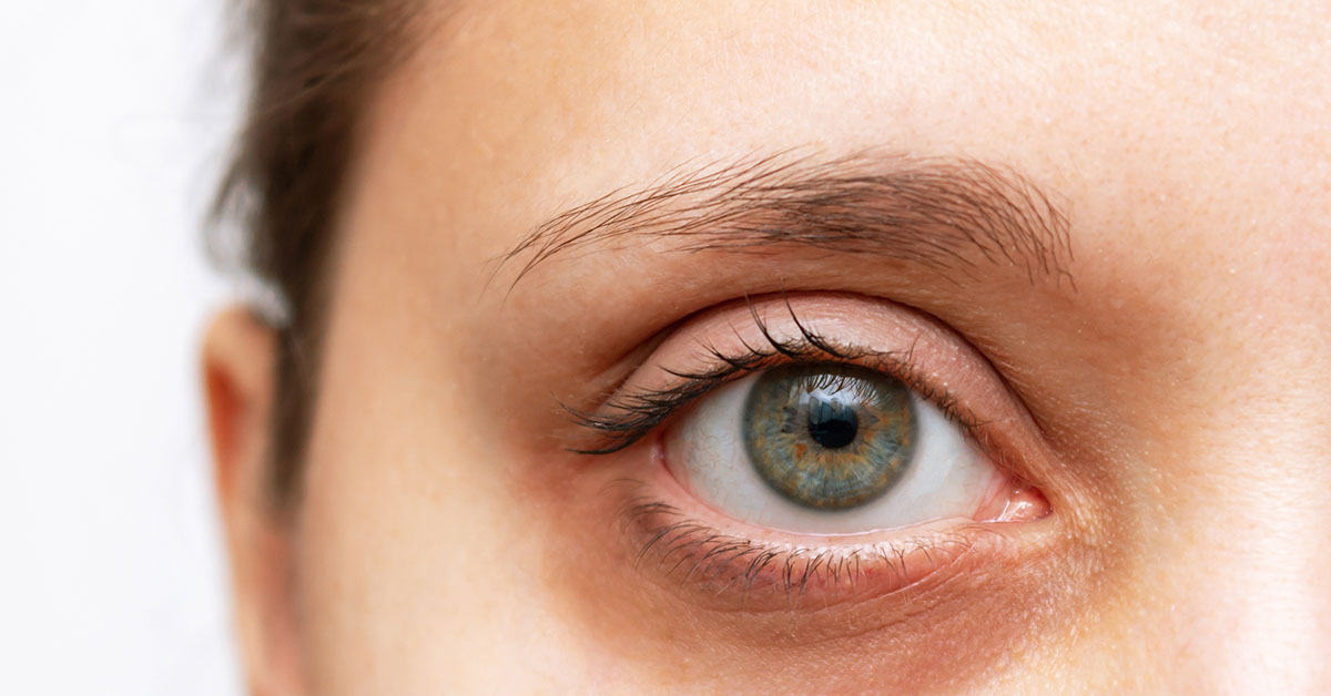 She Thought Her Twitching Eye Was Just Stress—The Shocking Diagnosis Changed Her Life Forever