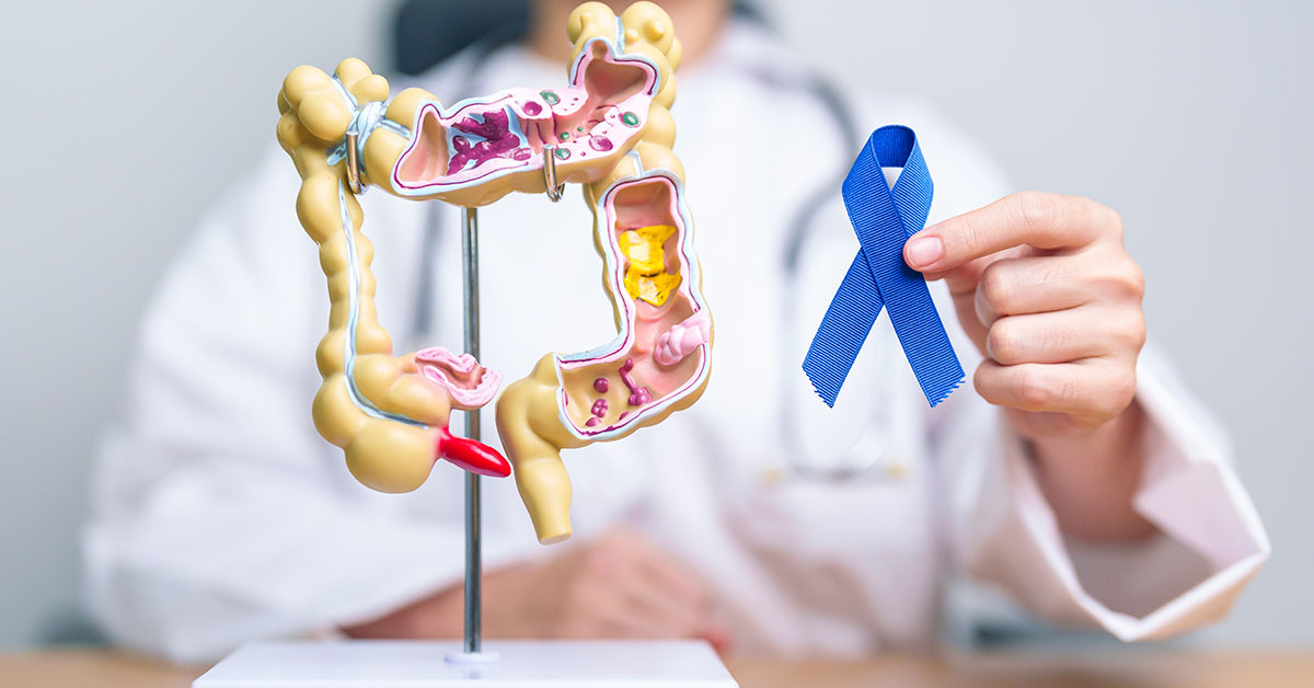 Woman reveals five colon cancer symptoms that should not be ignored