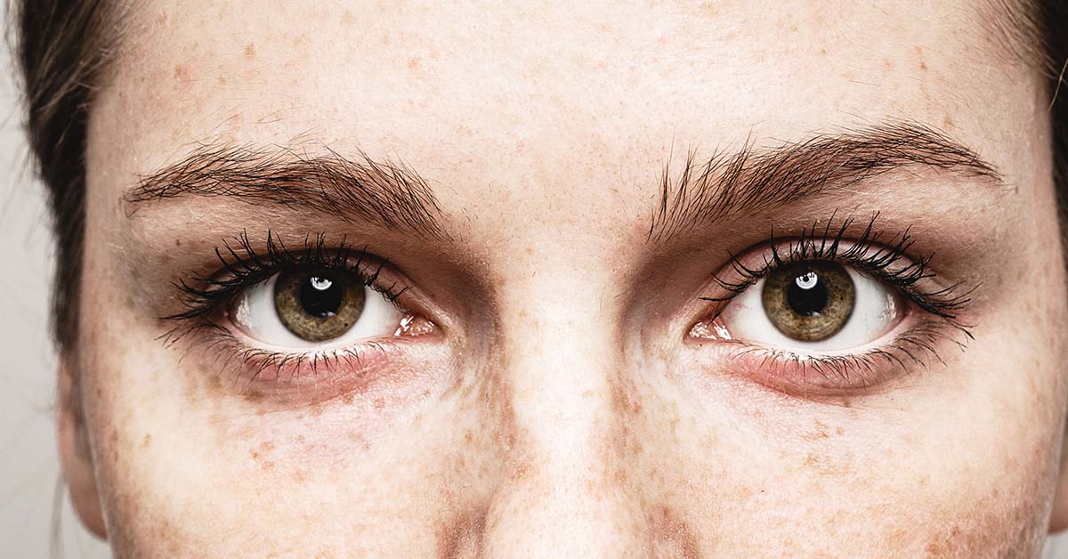 Seven Eye Changes That Should Never Be Overlooked, According to Experts