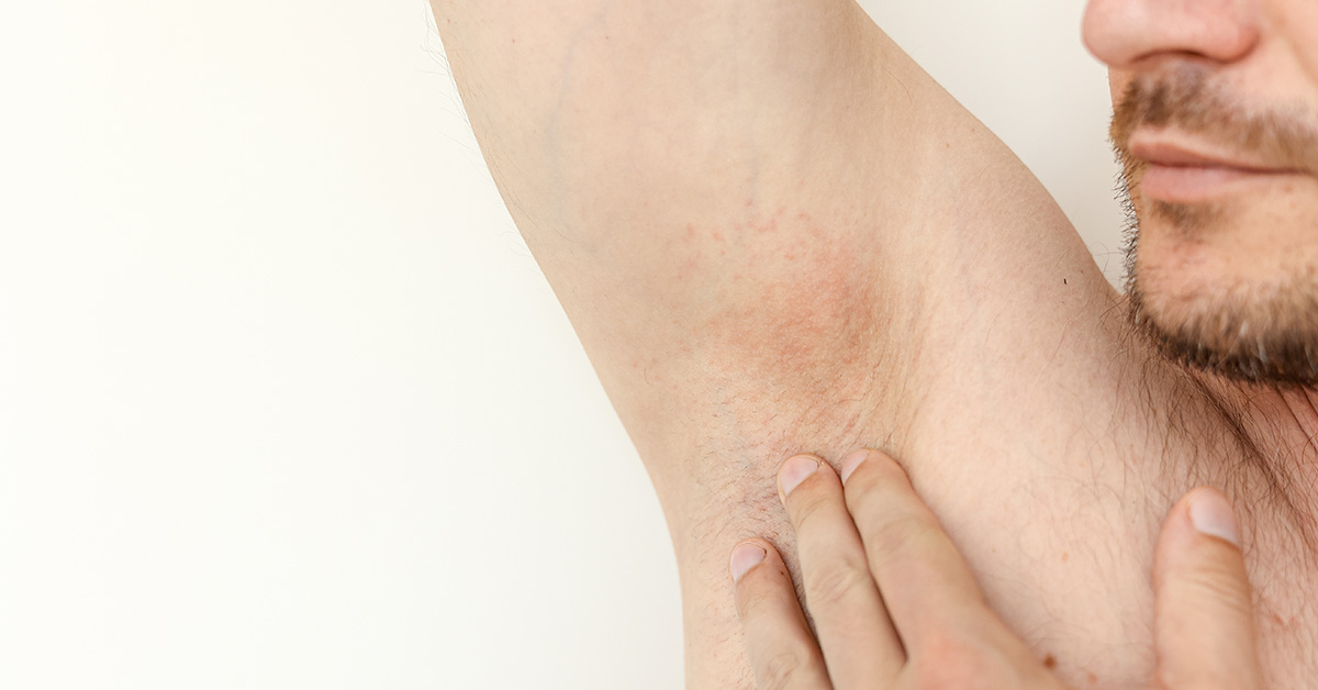 The Common Habits That Can Cause Bumps Under The Arms & What to Do