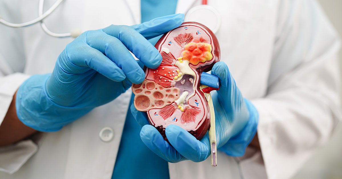 New Study Reveals Concerning Cause Behind Certain Kidney Damage