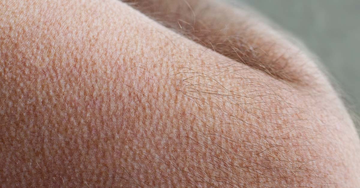 You Might Have a Special Brain If You Get Goosebumps When You’re Listening to Music
