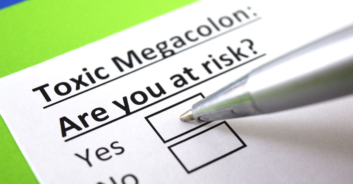 10 Signs of Toxic Megacolon