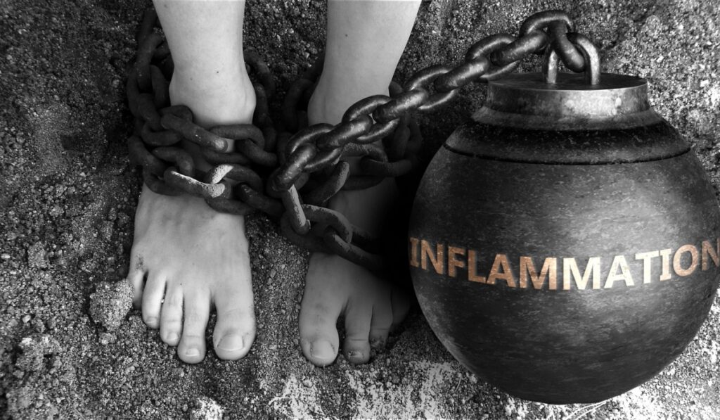 Inflammation as a negative aspect of life - symbolized by word Inflammation and and chains to show burden and bad influence of Inflammation, 3d illustration