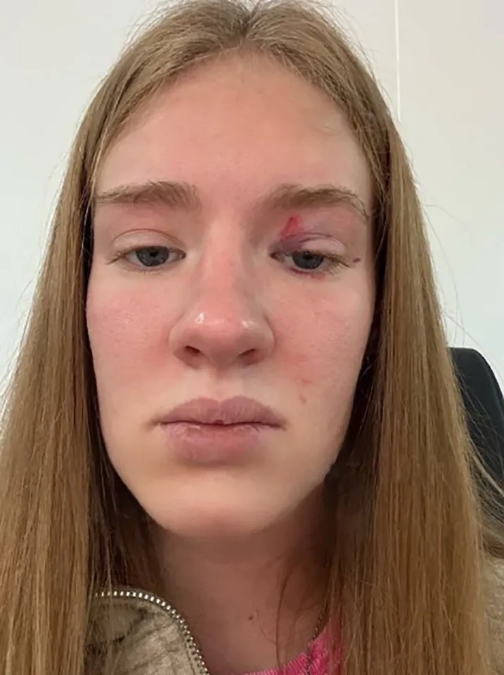 Masha's injuries after the ordeal