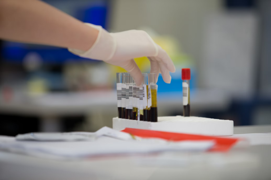 A researcher in a lab coat examines a blood tube, exploring the mysteries of aging's sudden spikes.