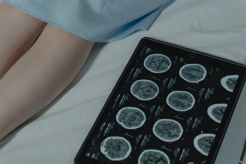 pictures of brain tumors