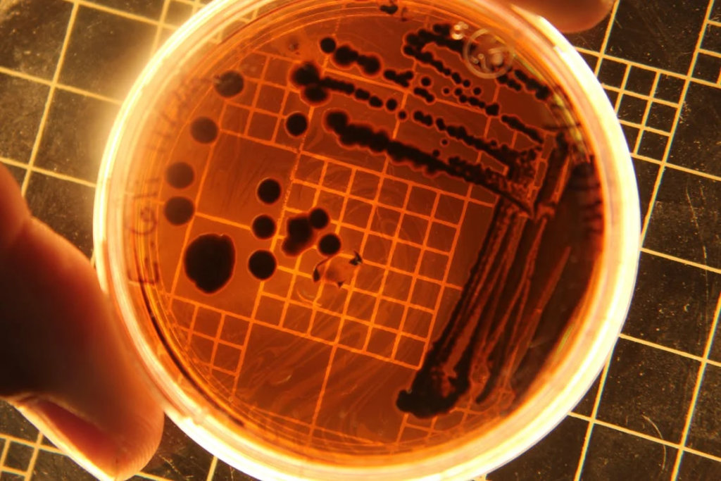Bacterial Colonies Shown Under a Light