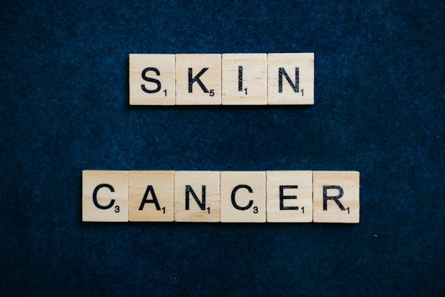skin cancer scrabble letters, signs of skin cancer