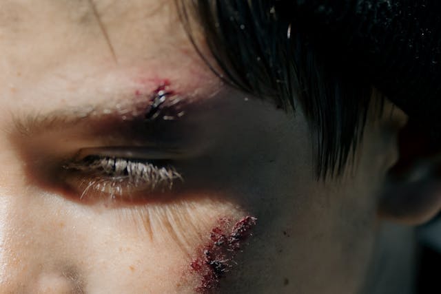 boy with facial wounds