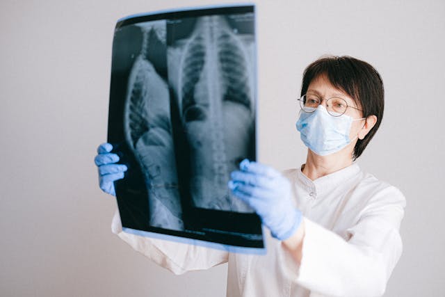 Doctor holding up lung cancer x-rays