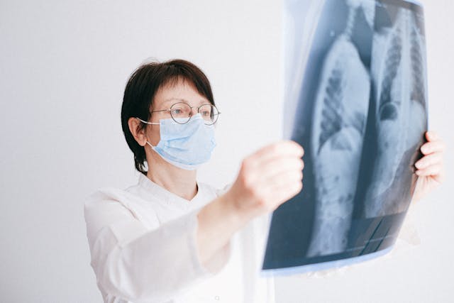 doctor looking at lung x-rays