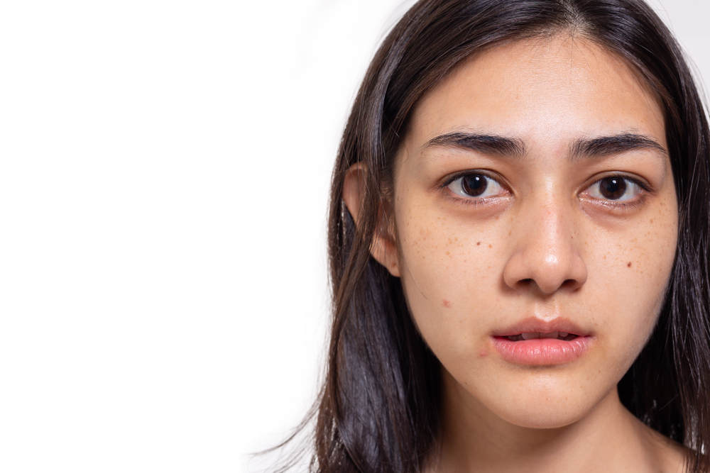 Asian woman gets freckles, blemish, pimple and dull skin on her face. Attractive beautiful Asia woman get eye dark circles, She get no makeup on face. She look unhappy. isolated on white, copy space