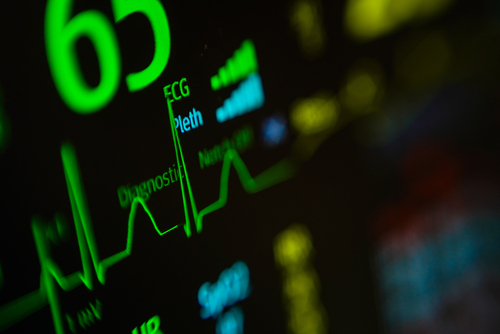 Heart Beat Rate Monitor,closeup view of an ecg ekg display