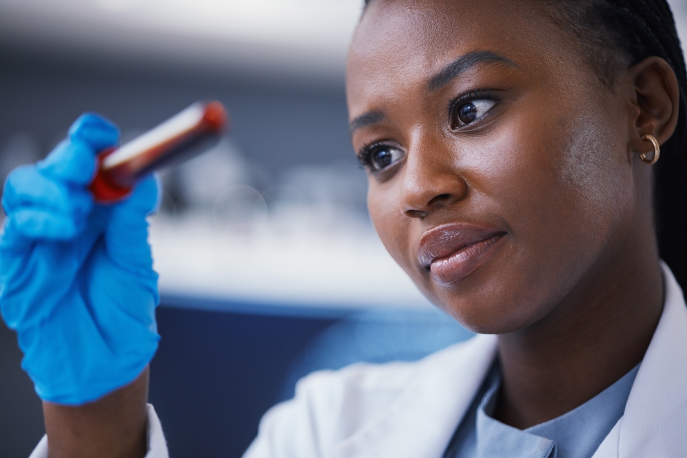 Science, blood vial and female scientist in a lab working on a medical experiment, test or exam. Biotechnology, pharmaceutical and African woman researcher doing scientific research in a laboratory.