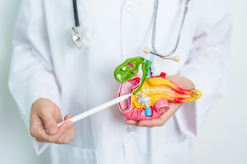 Doctor with human Pancreatitis anatomy model with Pancreas, Gallbladder, Bile Duct, Duodenum, Small intestine. Pancreatic cancer, Acute and Chronic pancreatitis, Digestive system and Health concept