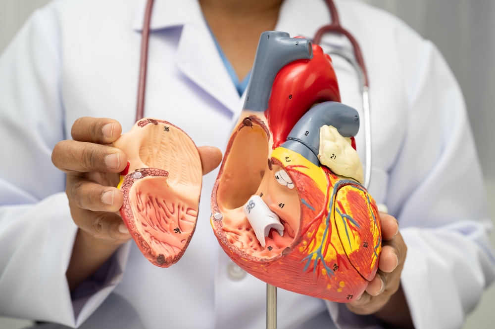 Cardiovascular disease CVD, doctor with heart human model anatomy for treatment patient in hospital.

