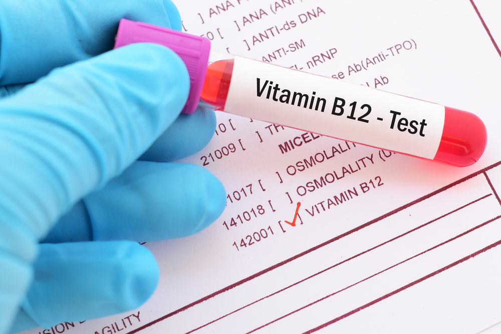 Blood sample with requisition form for vitamin B12 test
