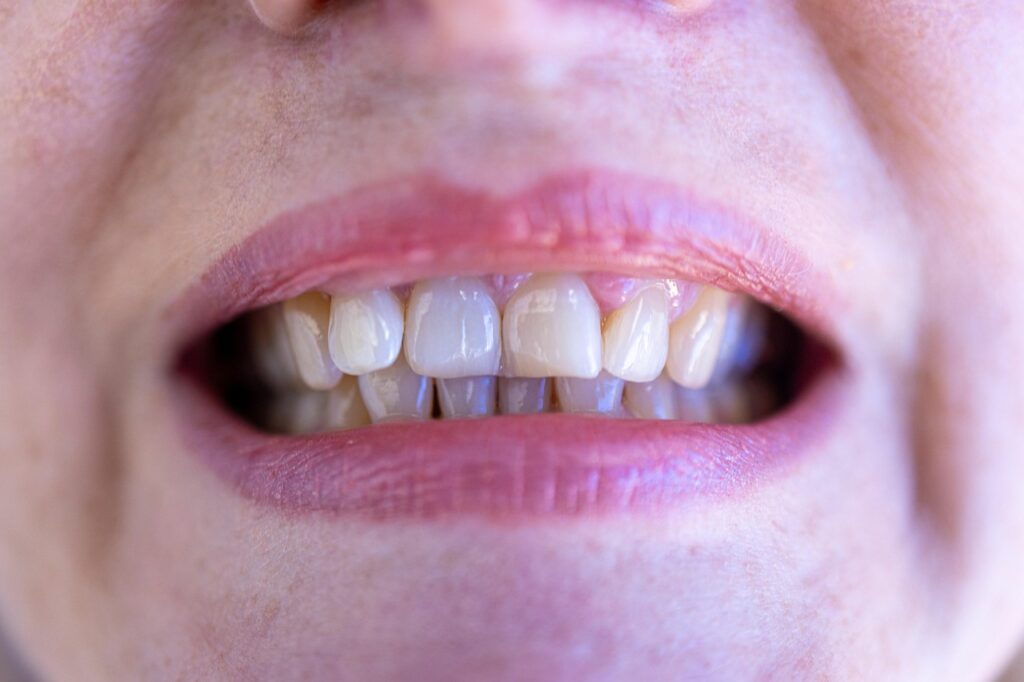 Teeth, Mouth, Face image.