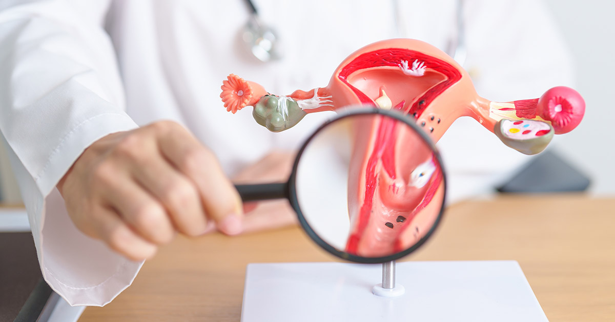 How Much Do You Know About Cervical Cancer?